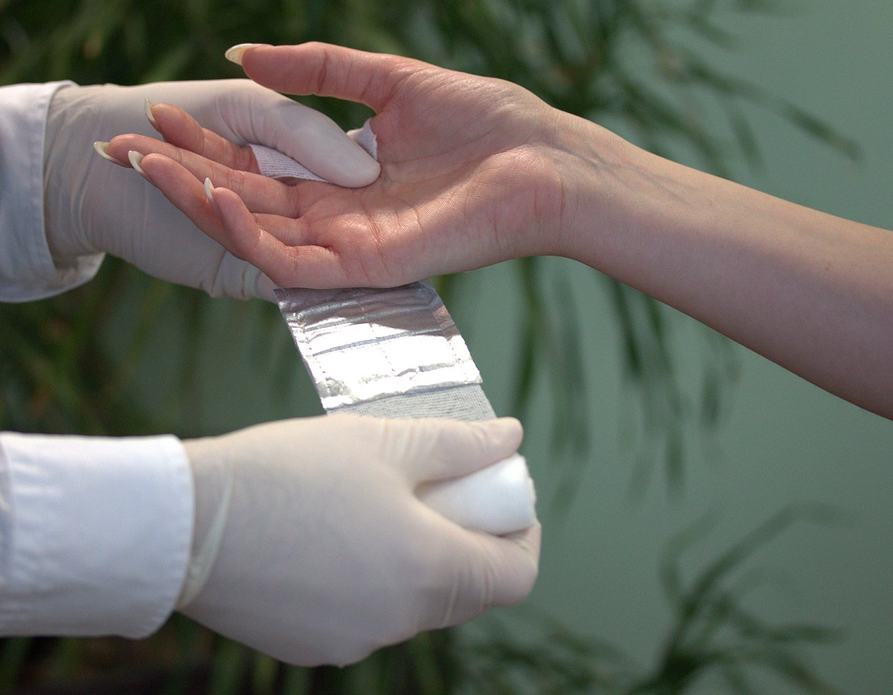 Versorgung von verletzter Hand mit Aluderm 