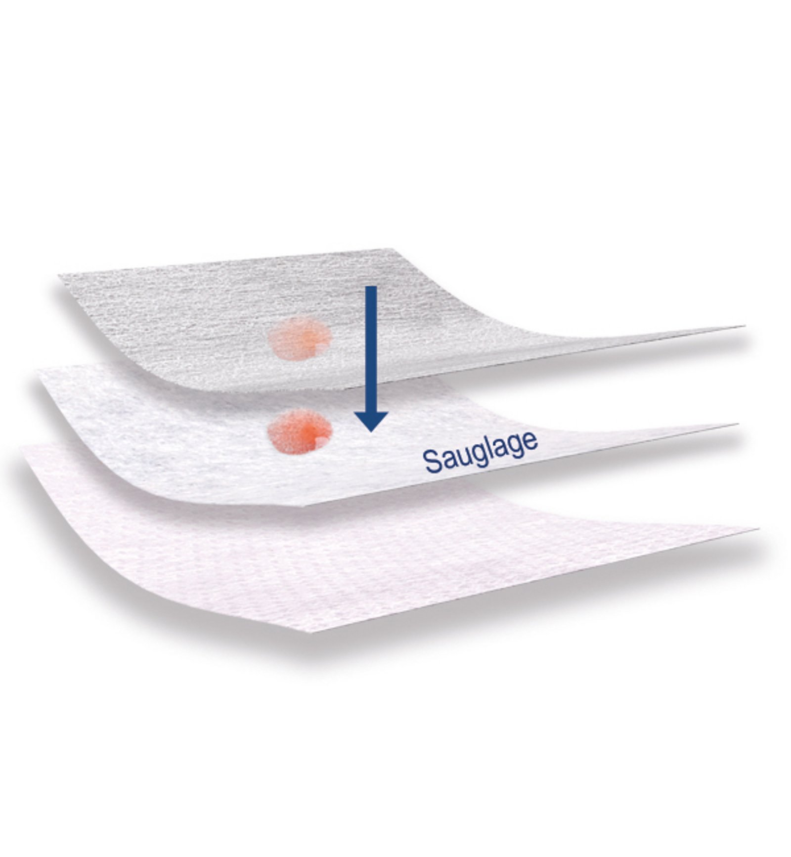 Aluderm Produktaufbau Wundverband einzelne Lagen